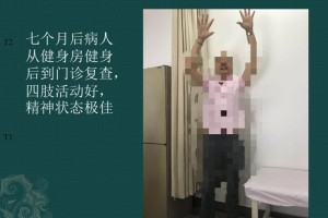 一例巨大脑室内肿瘤的手术医治——手术后七个月患者从健身房快乐地来到门诊